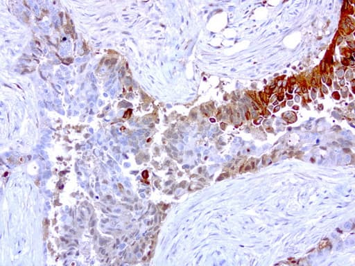 MMP7 / Matrilysin Antibody (aa95-267, clone UMAB168)