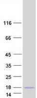 Human CCL15 / MIP5 Protein (Recombinant Myc-DDK (Flag))