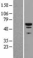 PI4K2B Protein (Over-Expression Lysate Myc-DDK (Flag))