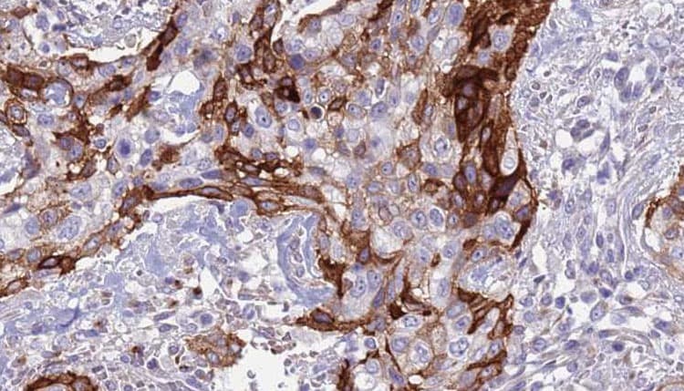 ACVR2 / ACVR2A Antibody