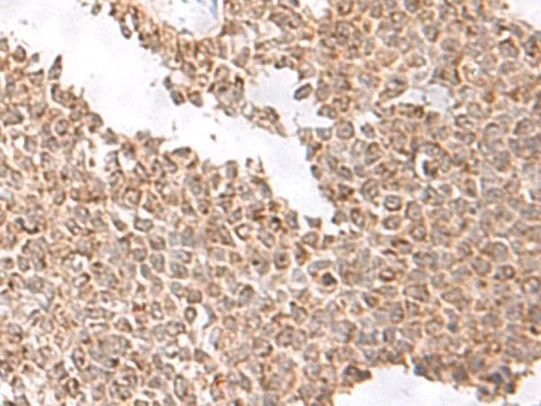 USP16 Antibody