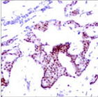 RELA / NFKB p65 Antibody