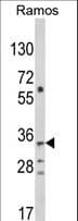 Polyclonal Rabbit anti-Human TBATA / C10orf27 Antibody (aa276-302, IHC, WB)