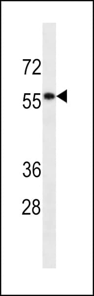 Monoclonal Mouse anti-Human DES / Desmin Antibody (WB)