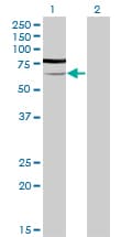 PGM3 Antibody (clone 1E2-1B12)