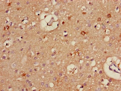 Polyclonal Rabbit anti-Human ALDH5A1 Antibody (aa48-535)