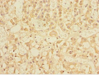 TRIAP1 Antibody