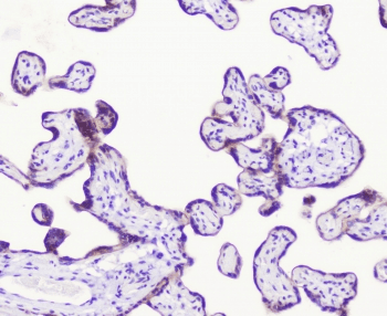 Polyclonal Rabbit anti-Human LATS1 Antibody (IHC, WB)