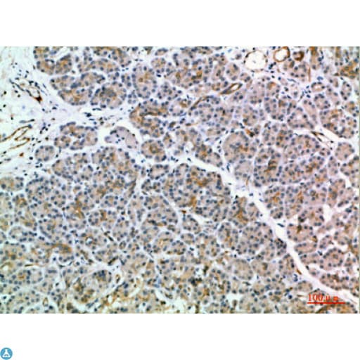 Polyclonal Rabbit anti-Human MIA2 Antibody (WB)