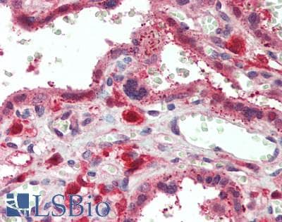IHC-plus™ PGM2L1 Antibody