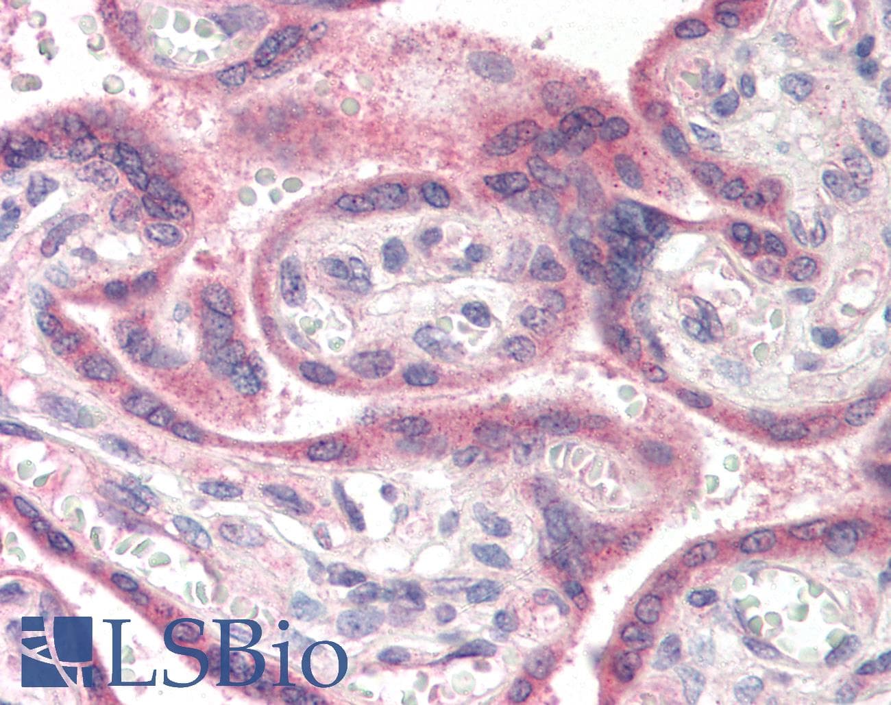 IHC-plus™ APH1A / APH-1 Antibody