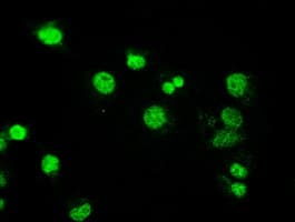 MAP2K4 / MKK4 Antibody (clone OTI1D6)