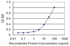 KRT5 / CK5 / Cytokeratin 5 Antibody (clone 1A12)