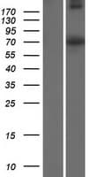 Human WEE1B / WEE2 Protein (Over-Expression Lysate Myc-DDK (Flag))