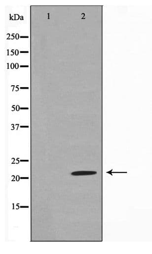CLDN7 / Claudin 7 Antibody