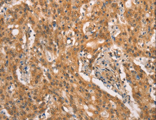 CRKL Antibody