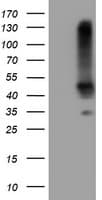 Monoclonal Mouse anti-Human SERPINB1 Antibody (clone OTI2B10, WB)