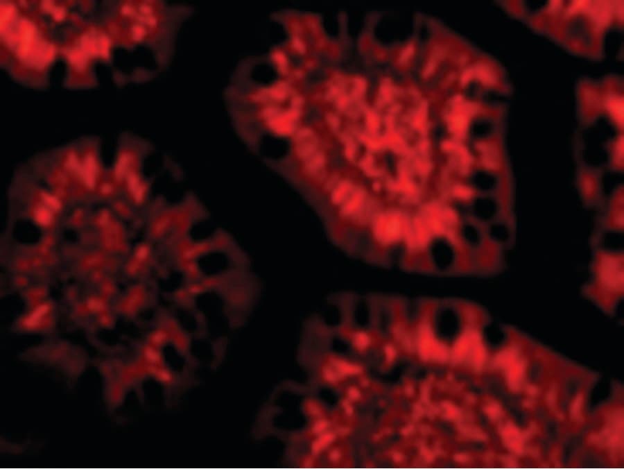 Polyclonal Rabbit anti-Human PHAP III / ANP32E Antibody (IHC, IF, WB)