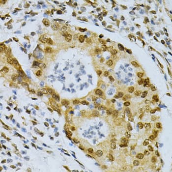 ELAVL1 / HUR Antibody