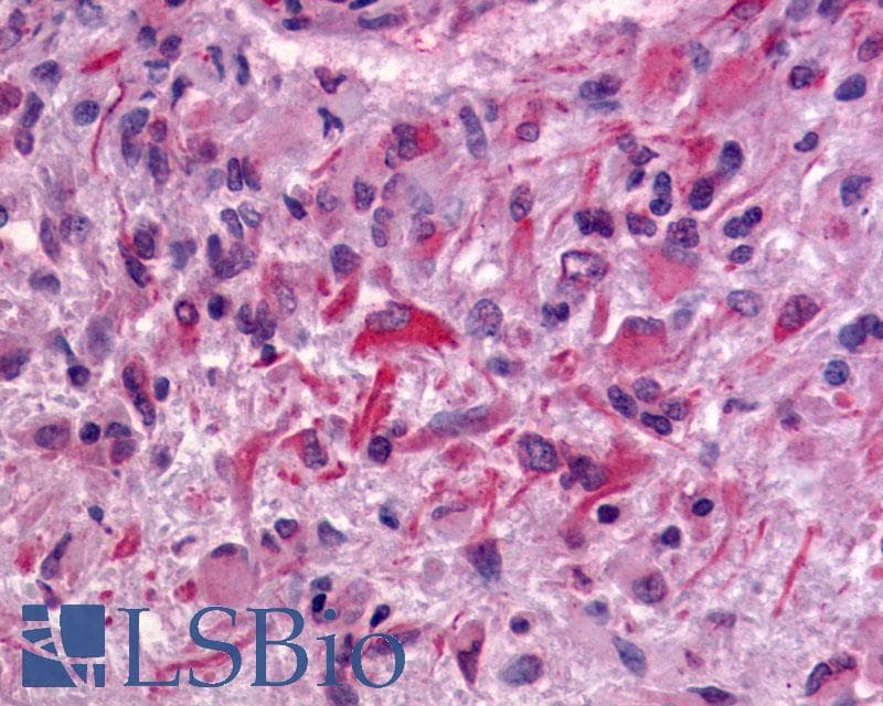 PathPlus™ ADGRG2 / GPR64 Antibody (C-Terminus)