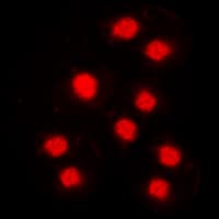CCNA1 / Cyclin A1 Antibody (C-Terminus)