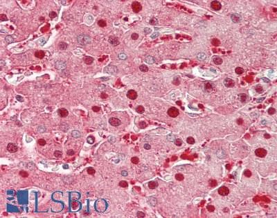 IHC-plus™ SOD1 / Cu-Zn SOD Antibody (clone 8B10)