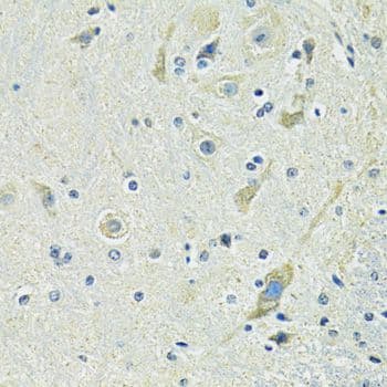 SLC1A4 / ASCT1 Antibody