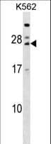 TRAT1 / TRIM Antibody (aa98-127)