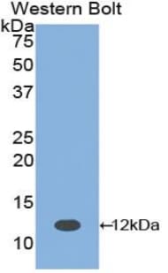 PTH / Parathyroid Hormone Antibody (aa32-119)
