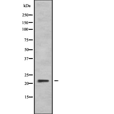 Polyclonal Rabbit anti-Human DIRAS2 Antibody (WB)
