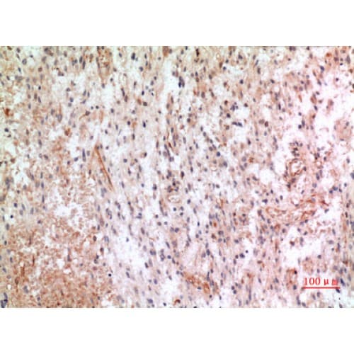 CX3CL1 / Fractalkine Antibody (221-270 aa, Internal)