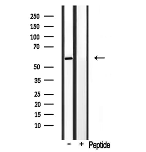 CYP3A4 / Cytochrome P450 3A4 Antibody