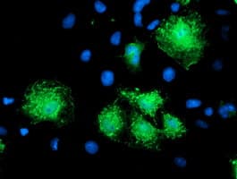KATNB1 Antibody (clone OTI5A10)