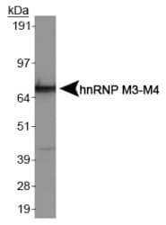Nuclear Ribonucleoprotein M3/M4 Antibody (clone 2A6)