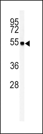 Aspartate Aminotransferase Antibody (aa352-381)