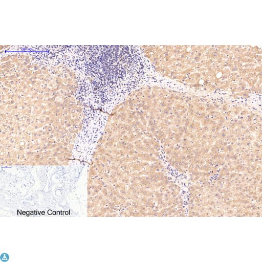 APG5 / ATG5 Antibody