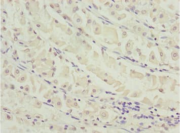Polyclonal Rabbit anti-Human MEOX1 Antibody (IHC, WB)