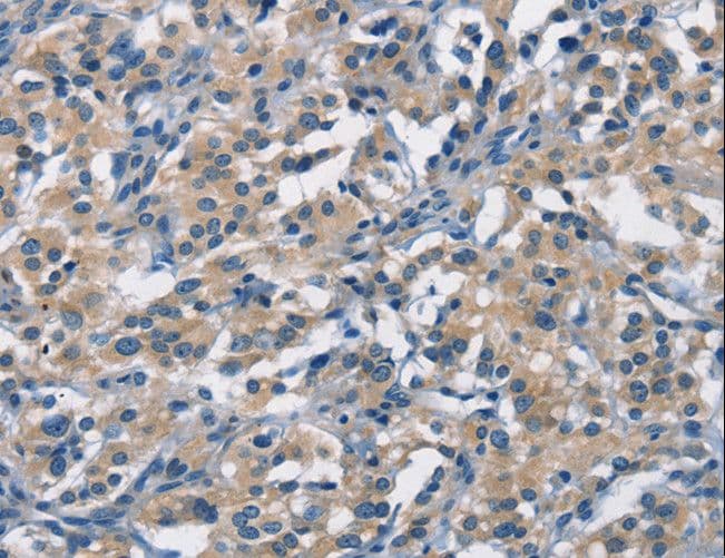 IHC-plus™ APOL1 / Apolipoprotein L Antibody
