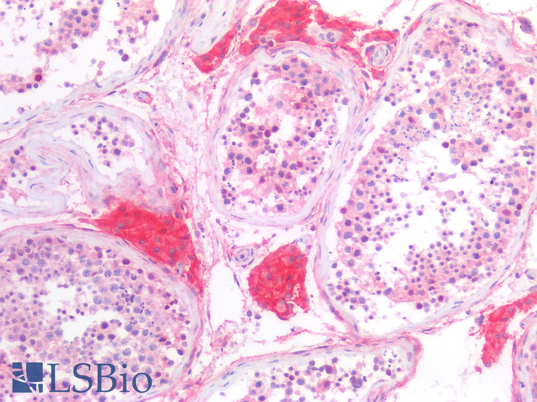 PathPlus™ Polyclonal Rabbit anti-Human CD276 / B7-H3 Antibody (aa47-219, IHC, WB)