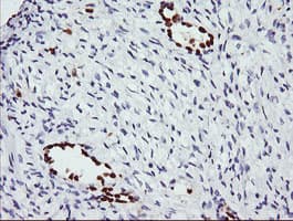ERG Antibody (clone OTI5F12, Carrier-free)