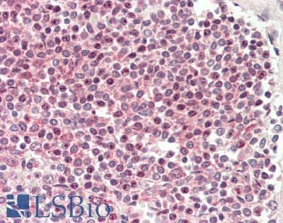 IHC-plus™ Polyclonal Rabbit anti-Human PPP1CA / PP1-Alpha Antibody (aa280-C-term, IHC, WB)
