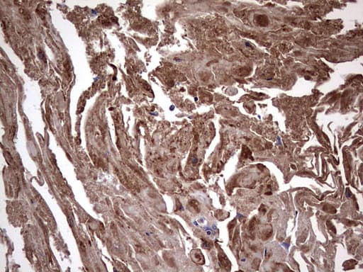 IL1RN Antibody (clone OTI2B1)