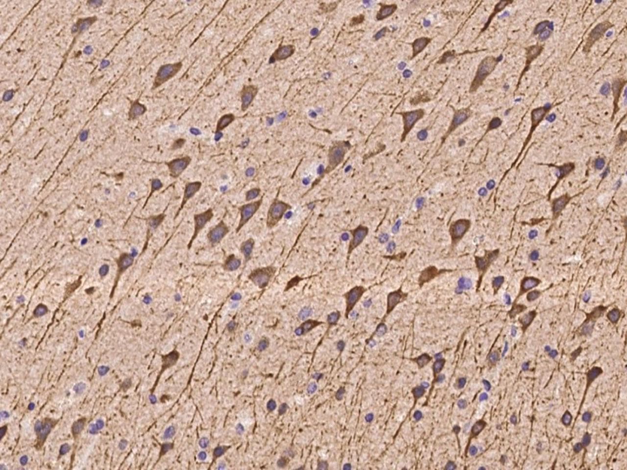Polyclonal Rabbit anti-Human NECAP2 Antibody (IHC)
