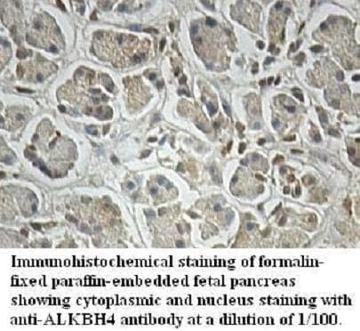 Polyclonal Rabbit anti-Human ALKBH4 Antibody (aa38-282, IHC, WB)