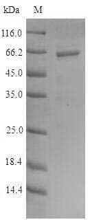 Human PSMB10 Protein (Recombinant GST, N-terminus)
