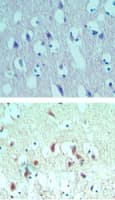 EIF4A2 Antibody (aa1-50)