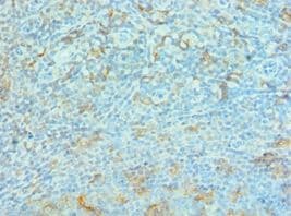 Polyclonal Rabbit anti-Human G3BP1 / G3BP Antibody (aa227-466, IHC, WB)