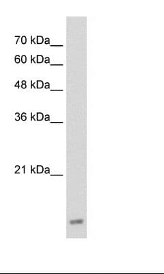 Polyclonal Rabbit anti-Human UBE2I / UBC9 Antibody (C-Terminus, WB)
