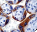 INHA / Inhibin Alpha Antibody (clone R1)