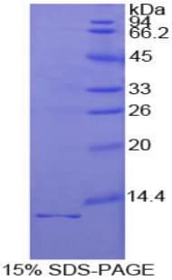 Human IL1R1 Protein (Recombinant His)